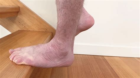 heel drop for plantar fasciitis.